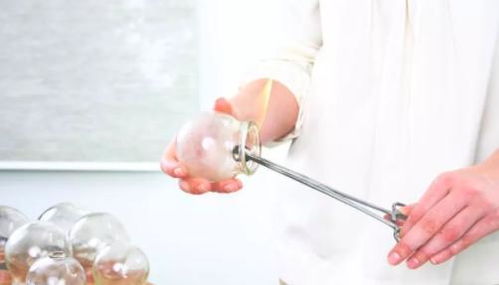 拔火罐時,皮膚留下的 黑紫色印記 ,真的是在排出體內毒素嗎