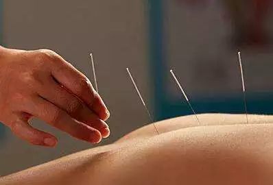 廣東醫(yī)保新舉措 針灸推拿納入報(bào)銷，助力中醫(yī)藥發(fā)展