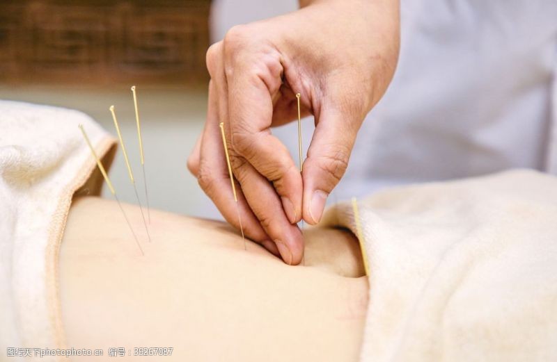 針灸 古老智慧的養(yǎng)身之道