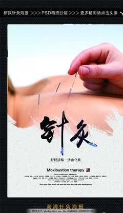 針灸 古老醫(yī)學(xué)的現(xiàn)代應(yīng)用