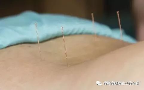 針灸減肥 至少半年的堅持與效果