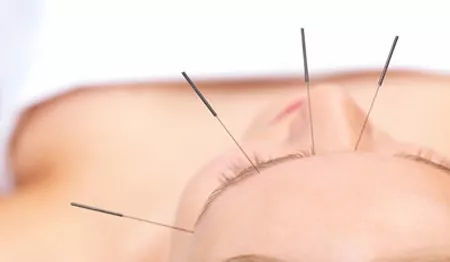 針灸減肥會反彈嗎？如何科學避免反彈