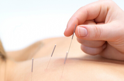 針灸的作用及針灸美容的好處